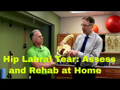Hip Labrum Tear- How to Assess & Rehab at Home