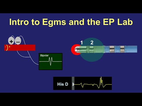 Intro to Intra-cardiac Electrograms & the EP Lab