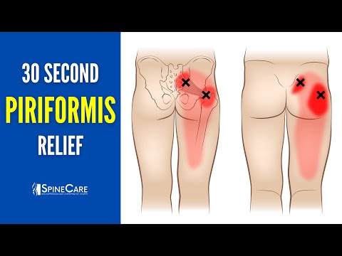 30 SECOND FIX: Instant Piriformis Pain Relief