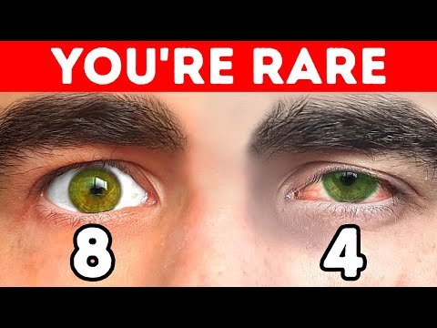 18 Rarest Body Features Your Friends Might Have