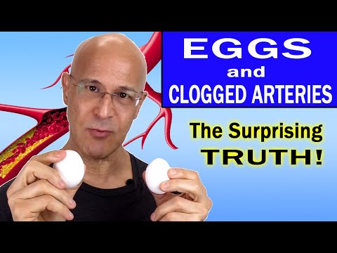 The Surprising Truth About Eggs and Clogged Arteries:  What You Need to Know!   Dr. Mandell