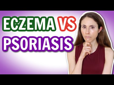 ECZEMA VS PSORIASIS: HOW TO TELL THE DIFFERENCE 🤔 @DrDrayzday