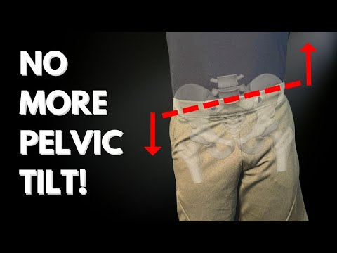 The Secret Formula To Fix Lateral Pelvic Tilt In 3 Days (Case Study)