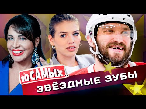 Звёздные зубы | Сколько стоят улыбки Шуры, Бабкиной, Чеботиной | Почему нет зубов у Овечкина