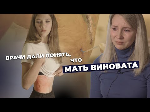 РУБЦОВАЯ ДЕФОРМАЦИЯ ТЕЛА ПОСЛЕ ОЖОГОВ | История Яны Муканиной