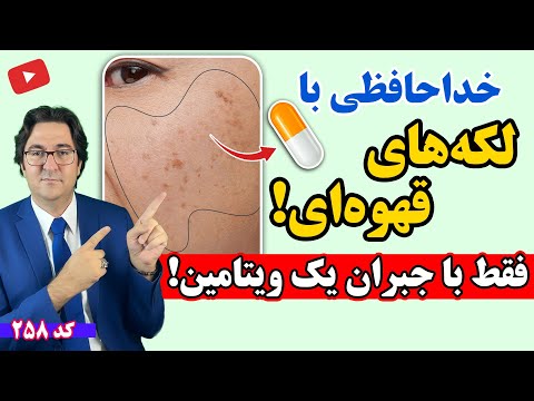 لکه های قهوه ای و پیری از کمبود این ویتامینه! | درمان فوری لکه های پوستی بدون دارو