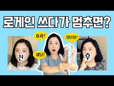 미녹시딜 로게인폼 2년 시행착오 끝에 깨우친 사용 방법(내돈내산 리뷰)