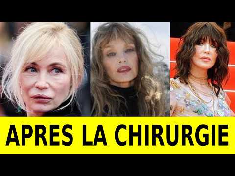 10 actrices françaises dont le visage a été transformé par la chirurgie esthétique