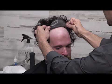 Men's Hair Replacement: The instant fix for bald or thinning men