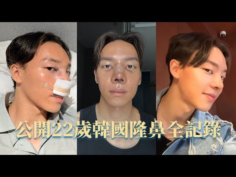 我飛到韓國整形了！男生隆鼻全紀錄