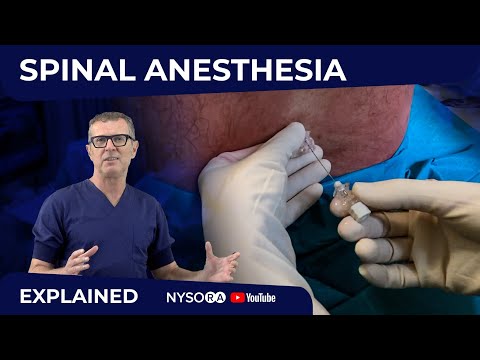 Spinal Anesthesia Explained Part 1- Crash course with Dr. Hadzic