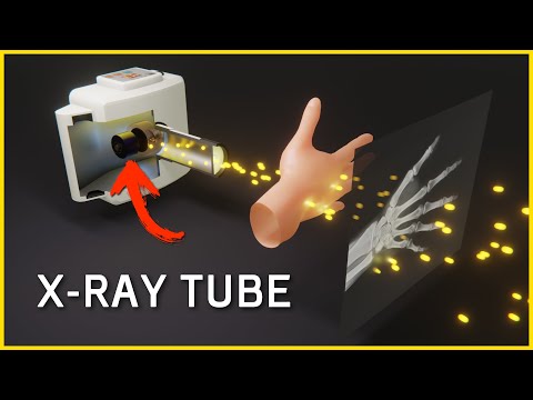 How an X-Ray Tube Works⚡How X-Rays are Generated