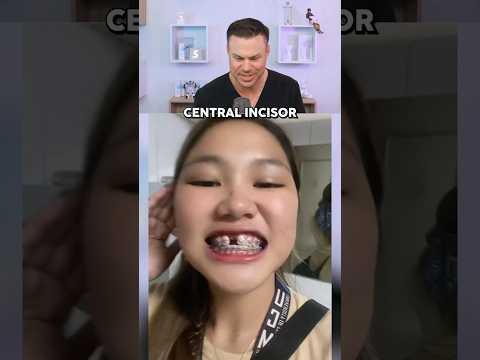 What REALLY Happens When You Get Braces?! 😮🦷