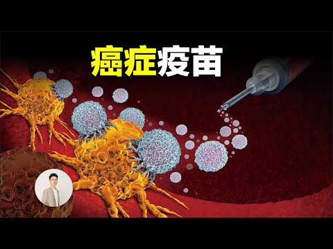 2025年諾獎得主認為人類20年內解決癌症,打一針就能解決所有癌症的疫苗為什麼這麼難設計,把癌細胞變成豬肉是什麼神操作?