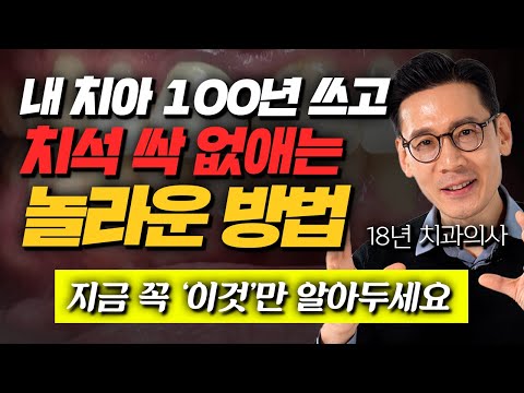 치과에 환자가 없어 고민입니다.. "치석, 잇몸병 싹 없애는 가장 확실한 방법" (오수환 원장 통합)