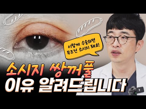 무조건 소시지 쌍꺼풀 만드는 수술법이 있었다?!?!