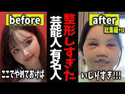 【ガルちゃん芸能】整形しすぎた芸能人・有名人 総集編3【有益2ch】