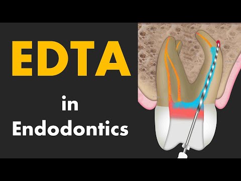 EDTA in Root Canal Treatment