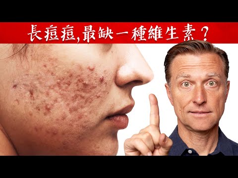 長痘痘,最缺一種維生素？自然療法,柏格醫生 Dr Berg