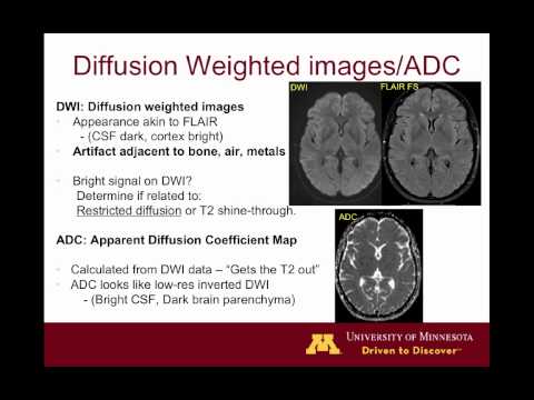 Brain MRI sequences 101