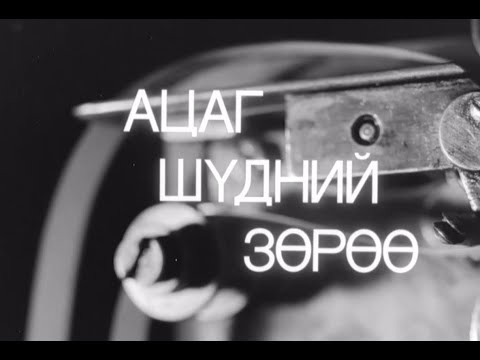 Ацаг шүдний зөрөө МУСК