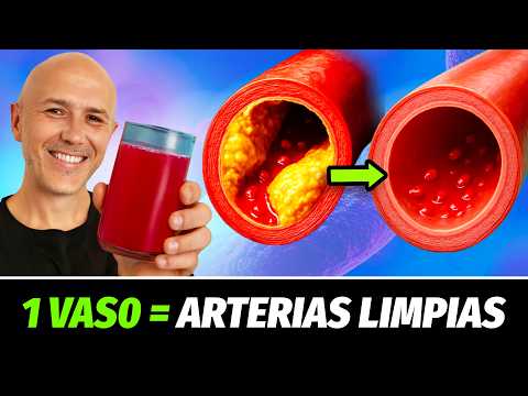 1 TAZA Para LIMPIAR tus ARTERIAS de forma NATURAL (Top 12 Alimentos) ¡Adiós Colesterol E INFARTOS!