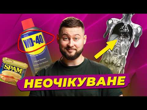 Запаморочення після вставання, МРТ всього тіла та неймовірні походження назв