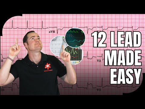 Master 12-Lead ECG Interpretation in 1 video