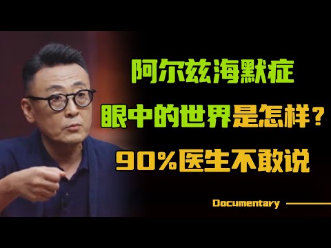 【圆桌派最新节目】阿尔兹海默症患者眼中的世界，是怎样的？真相让人心碎！#圆桌派 #许子东 #马家辉 #梁文道 #锵锵行天下 #观复嘟嘟 #马未都