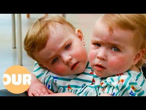 Katie and Eilish: The Unbreakable Bond of Conjoined Twins | Our Life