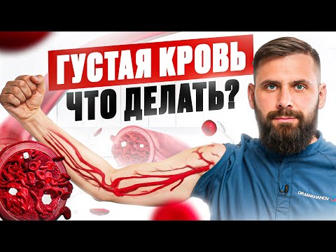 Лучше АСПИРИНА! Разжижение крови в домашних условиях БЕЗ таблеток – 4 способа