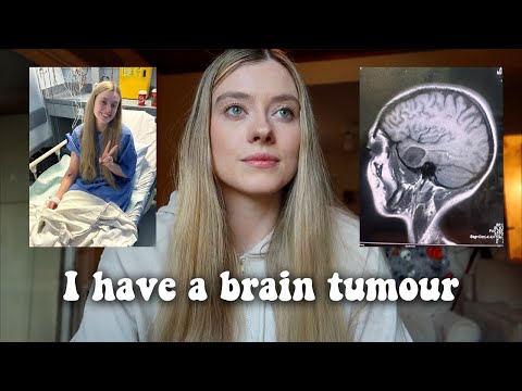I have a large brain tumour... How they found it, my signs and symptoms.