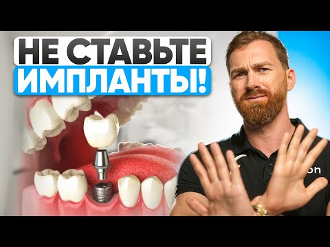 Вам НЕЛЬЗЯ ставить импланты! Стоматологи молчат об этом!