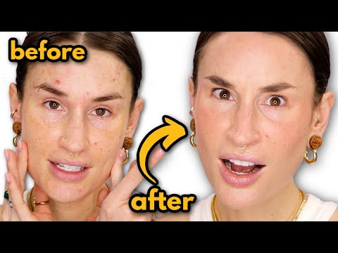 THIS is my new favorite concealer???