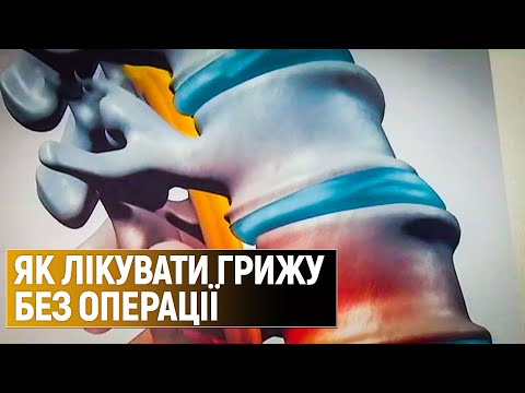 Чи можливо вилікувати грижу чи протрузію без операції – поради експертів