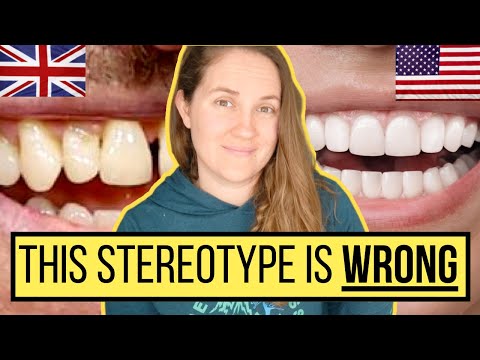 did you know THIS surprising truth about British teeth? UK vs USA teeth