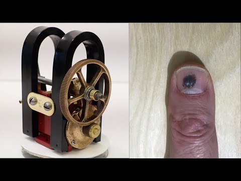 Magneto and Thumb Restoration