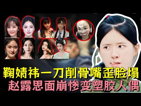 女星一刀削骨翻车太过惊悚，赵露思面崩惨变塑胶人偶，鞠婧祎修修补补嘴歪脸塌，杨紫、杨幂、沈梦辰、金晨、angelababy全部中招#赵露思 #鞠婧祎 #杨幂 #明星 #熱門 ##娱乐评论大赏 #娱乐圈