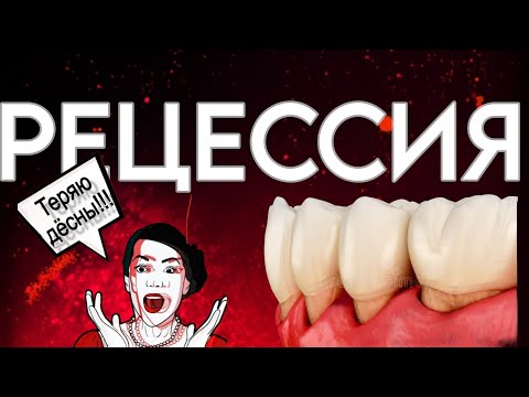 How I stopped a recession in 1,000 people. Why? What to do? How to stop it? Detailed instructions.