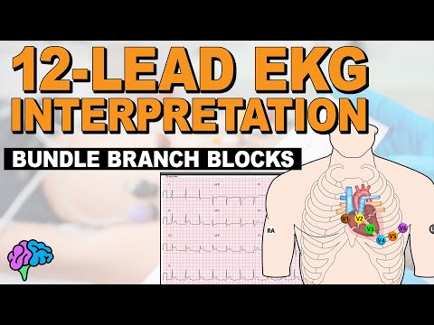 Bundle Branch Blocks MADE EASY!! - 12 Lead EKG