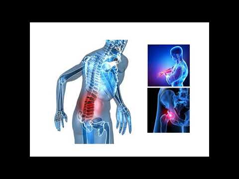 Common symptoms and presentations of Multiple Myeloma to primary care physicians