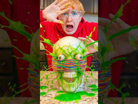 10,000 Rubber Bands vs Human Head!