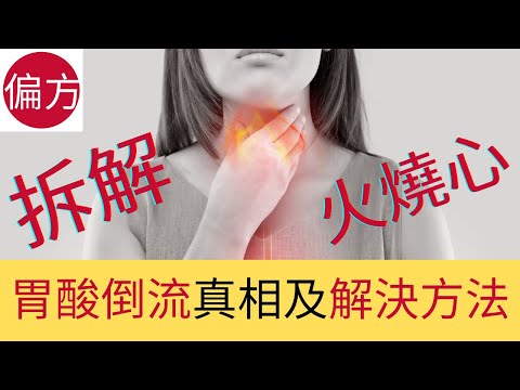 胃酸倒流自然療法