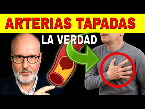 BLOCKED ARTERIES: Alarming Symptoms, Dangerous Myths (How to Know if You're at Risk)