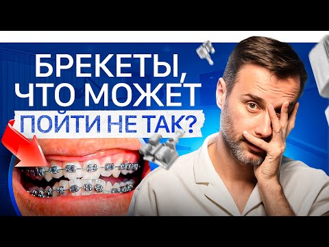Самые распространенные жалобы после брекетов — возможные последствия. Что делать?