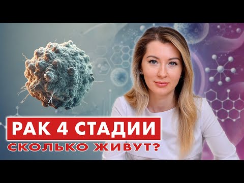 How long do people live with STAGE 4 CANCER? // #oncologistMochalova