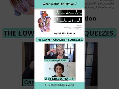 What is Atrial Fibrillation?