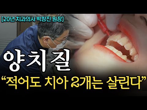 "치석 싹 녹아내린다." 평생 치과에 돈 안 써도 되는 최고의 양치질 방법 (박창진 원장 1부)