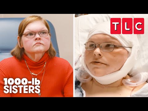 Tammy's Skin Removal Journey | 1000-lb Sisters | TLC