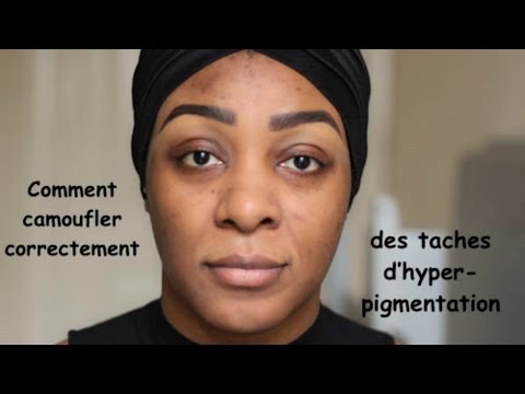 Comment: Camoufler des taches d'hyper-pigmentation (Peau Noir)